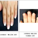 베이크네일