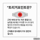 트리거짐 네이버블로그