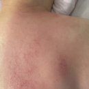 아르떼에스테틱 | 파주피부관리 아르떼 에스테틱 얼굴 스페셜 관리 등관리 후기