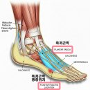 신의실천 | 족저근막염 때문에 러닝 포기 직전이라면? 저를 구원해준 신의 한 수