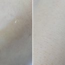 헤어시에프(CF) 이미지
