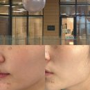 오휘에스테틱 | 삼송 마사지 피부관리 / 더아름다움TA에스테틱 등관리, 물광수딩케어 후기
