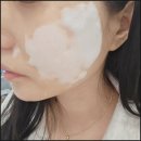 핌케어 네이버블로그