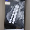 새연정형외과의원 | 전원, 전주정형외과,모래내정형외과,모래내시장, 친절한정형외과, 새연정형외과후기, 새연정형외과 후기