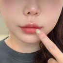 부산 서면 입술필러 성형외과 리얼후기 캐뉼라로 통증 없이 받았어요
