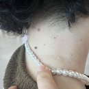 공항한의원 | 서면 편평사마귀 제거하러 피부한의원 가본 솔직 후기