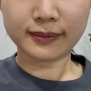 노은동 등관리 신부관리 잘하는 곳, 미사랑뷰티샵 솔직후기