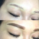 서울성형외과의원 이미지