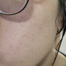 ㈜세일 | 올영세일 손상 피부 장벽 지피덤 EGF 바이오 크림 지피덤 이지에프 스킨 베리어 인텐시브 크림