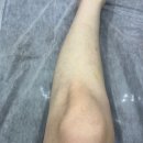 김해바른병원 | 김해 부원동 왁싱 잘하는 뷰티하이브왁싱 후기