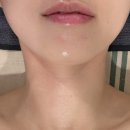 은하스킨케어