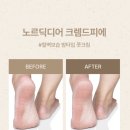 디아트네일
