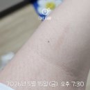 겔배하우스 | 하우스윗 트지마겔 내돈내산 후기긁힌 붉은 흉터 관리에 사용해 본 솔직 리뷰