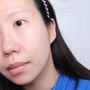 블루테라피에스테틱 이미지