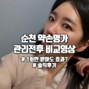 순천 약손명가, 작은 얼굴 관리받기 1회 받아 본 솔직 후기 (before&amp;after)