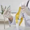 내가 맞은 ‘무릎관절주사’도?…‘첨단재생의료’ 거짓·과대광고 적발 이미지