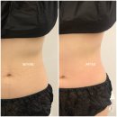브릴란떼 | 부산 바디 관리 추천 서면 피부관리 브릴란떼뷰티 바디 인치 컷 솔직 후기