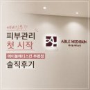 [후기] 예비신부 피부관리 첫 시작✨ 에이블메디스킨 부평점 내돈내산 솔직후기