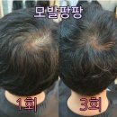 Q사랑염색방 이미지