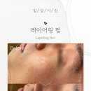 스킨라이프