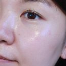 보람메디칼 네이버블로그