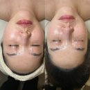 리베 | 해운대 센텀피부관리 리베룩 후기 헤스티움