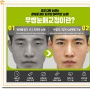 미호성형외과의원 이미지