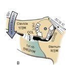 본정형운동