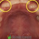 형제기공사 네이버블로그