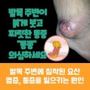 류마사랑내과의원 네이버블로그
