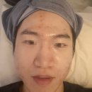 새숨바이오 | 송파여드름케어 찾는다면? 마이왁싱앤브로우 바이오리필 관리 후기