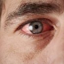 안경, 여수 이미지