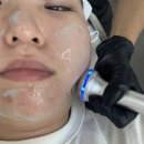 뷰티soo | 인천 미작뷰티 피부관리 후기 | 잡티제거 + LDM 물방울 초음파 + 톤업 관리 전후 비교