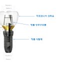 미래연세치과 이미지