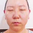 햅번헤어 - 남양주시 | 군산 얼굴축소관리 얼굴선햅번스타일 오드리관리 후기