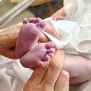미래여성병원 | 38주차 2일 응급제왕수술 임신성당뇨 산모 삼성미래여성병원 출산 후기