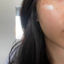 강남유앤아이의원 | [일상] 유앤아이의원 선릉점 색소시술 내돈내산 / 레이저 후기 (큐라스, 클라리티, 더마브이)