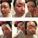 365담이약국 | 포니뷰티마켓)클랍아사필키트/아사필홈필링제,비밸런스알라앰플,비밸런스앰플,큐프라팩-동안팩,승무원팩...