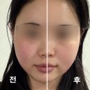 후스킨 - 북구 만덕대로 9 | 대구 이곡동 피부관리실 윤곽관리 잘하는 후스킨앤바디 후기