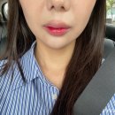 (주)바칸 | 서울 :: 강남 / 서초 티타늄 리프팅 레이저 잘하는 피부과 리얼 후기