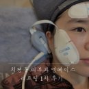 세명의료기기 | 광주 치평동 피부과 엠페이스 리프팅 1차 후기