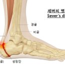 발 뒤꿈치 들기" 운동. 이미지