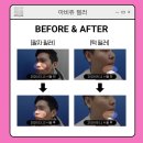 아비쥬의원부평 이미지