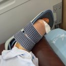 연세서울병원 | 연세건우병원 종자골 골절 수술 치료 과정 실제 후기 2