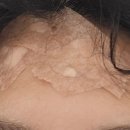 서울올업피부과의원 네이버블로그