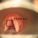 성대 이미지