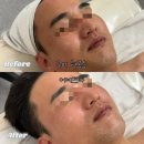 형곡로 | 구미 피부관리 “어여쁘다” 형곡동 에스테틱 모공탄력수분 피부맞춤PT 후기