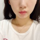 수원웨딩케어 추천 피부활력연구소 피부활력윤곽케어 받고 턱선 변화 후기