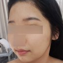 내일의얼굴 | 연신내 피부관리 내일의 피부 에스테틱 솔직 후기