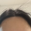 모모헤어라인 이미지